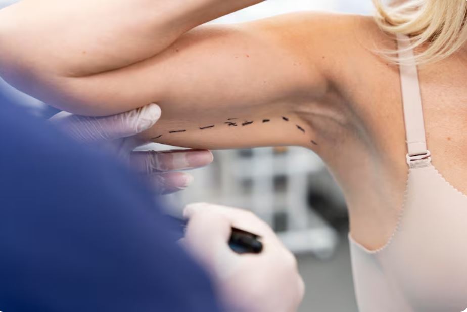 josie gibson arm lift surgery
